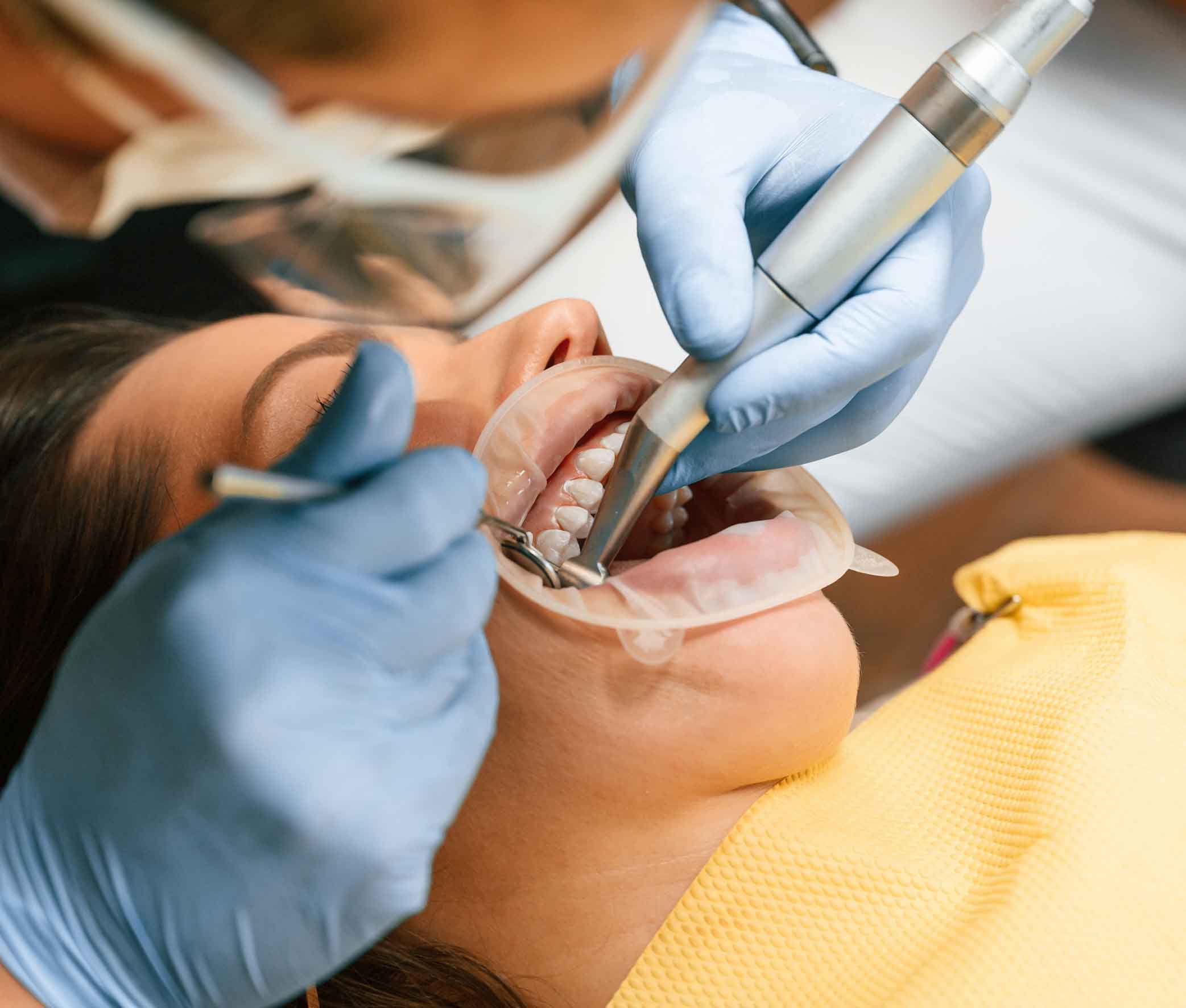 implant cleaning